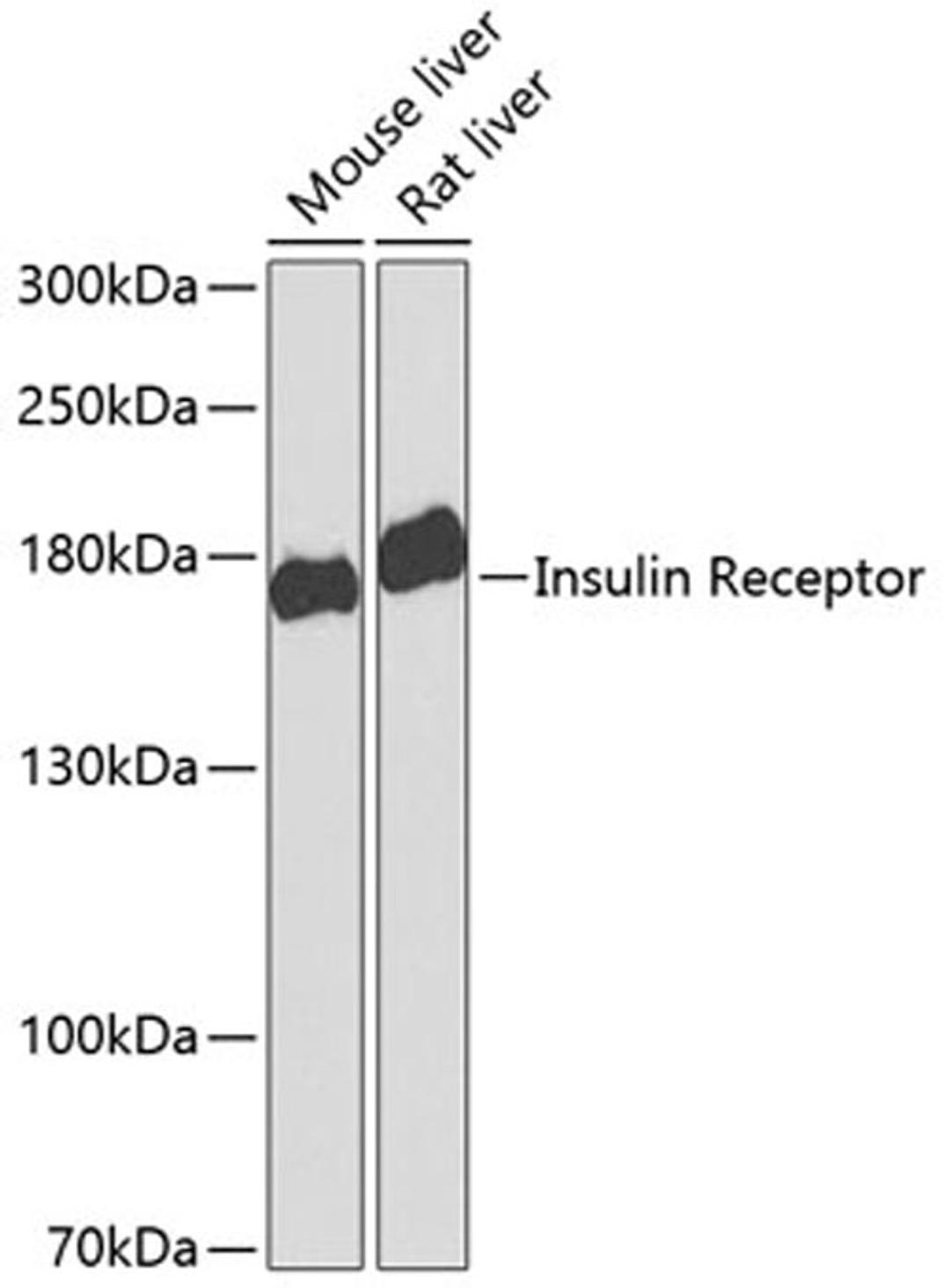 Western blot - Insulin Receptor antibody (A0287)