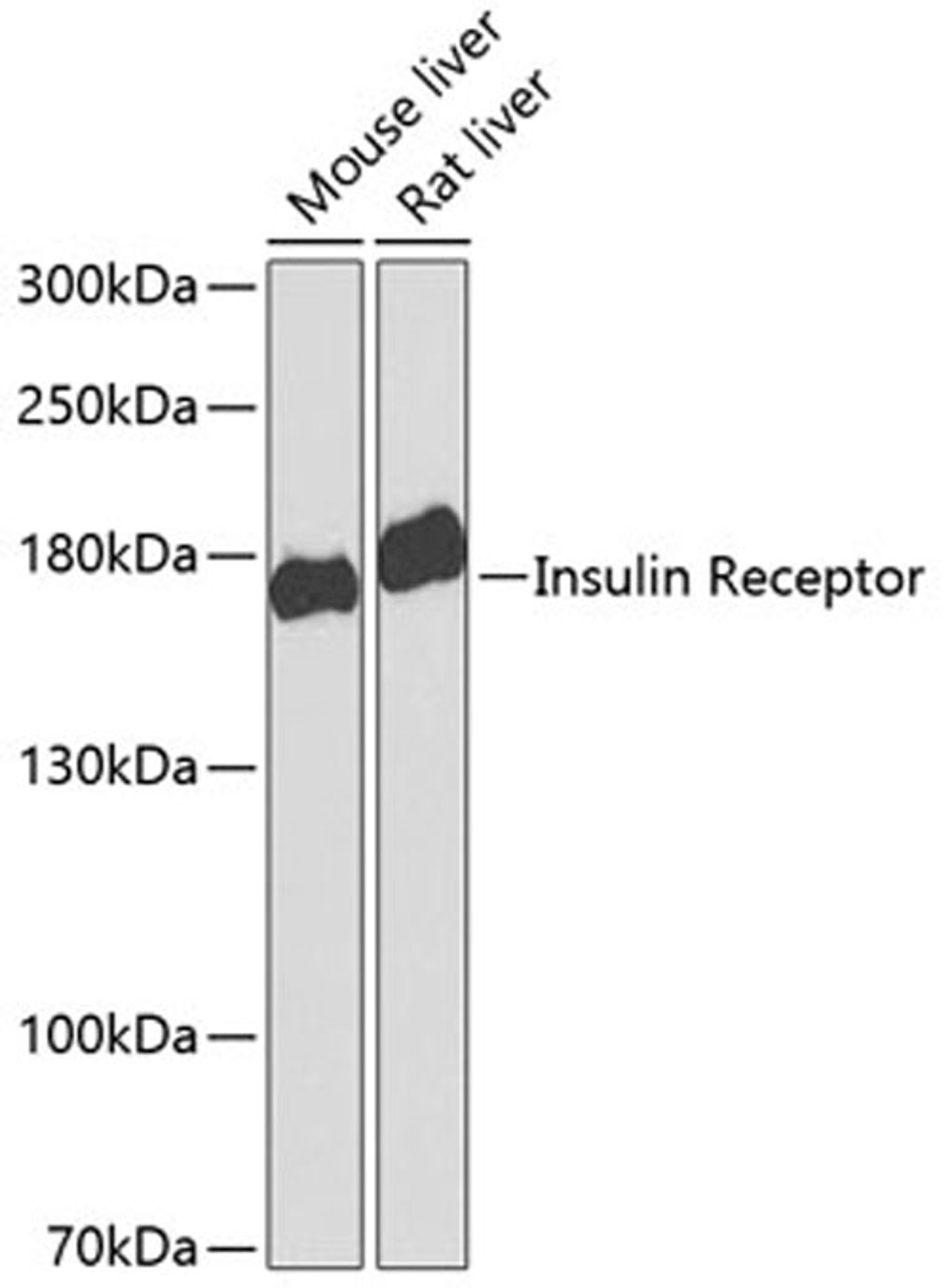 Western blot - Insulin Receptor antibody (A0287)