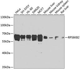 Western blot - RPS6KB2 antibody (A1541)