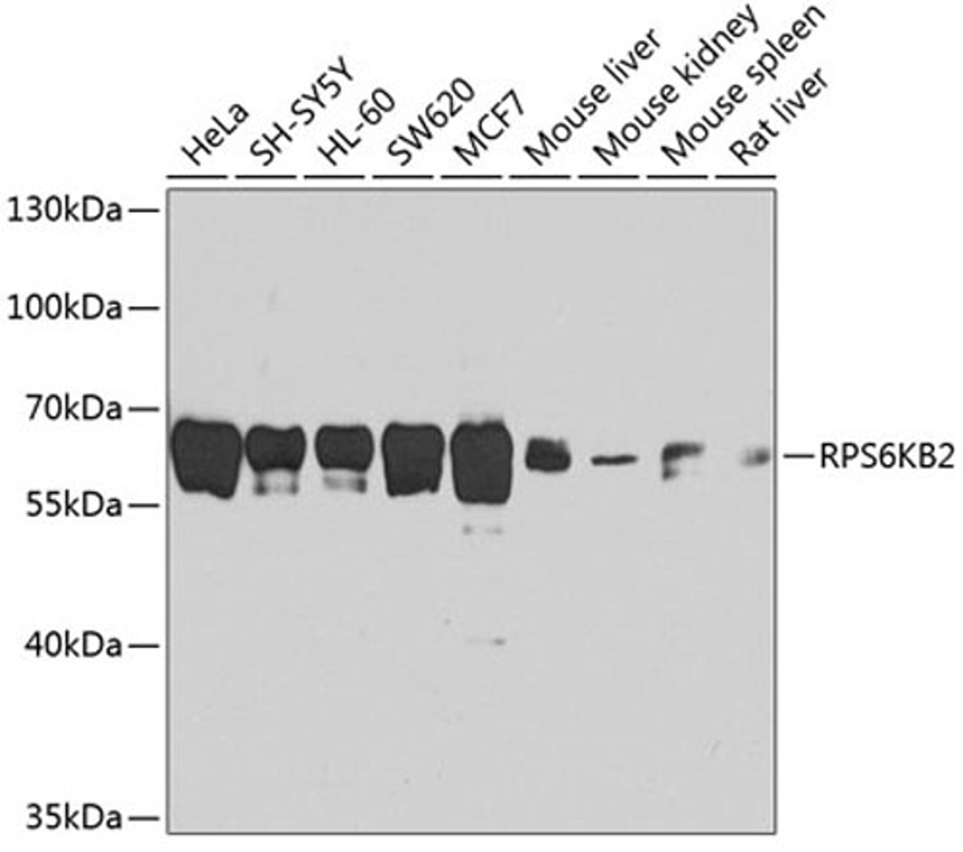 Western blot - RPS6KB2 antibody (A1541)