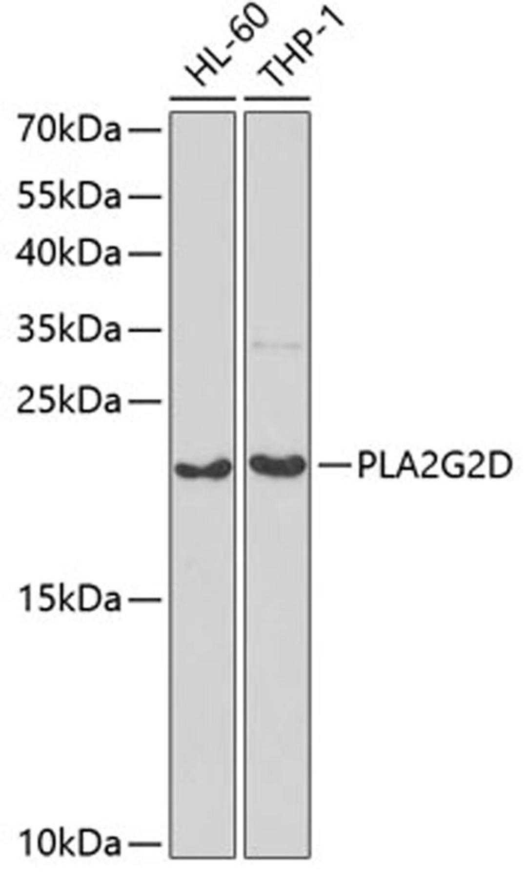 Western blot - PLA2G2D antibody (A6690)