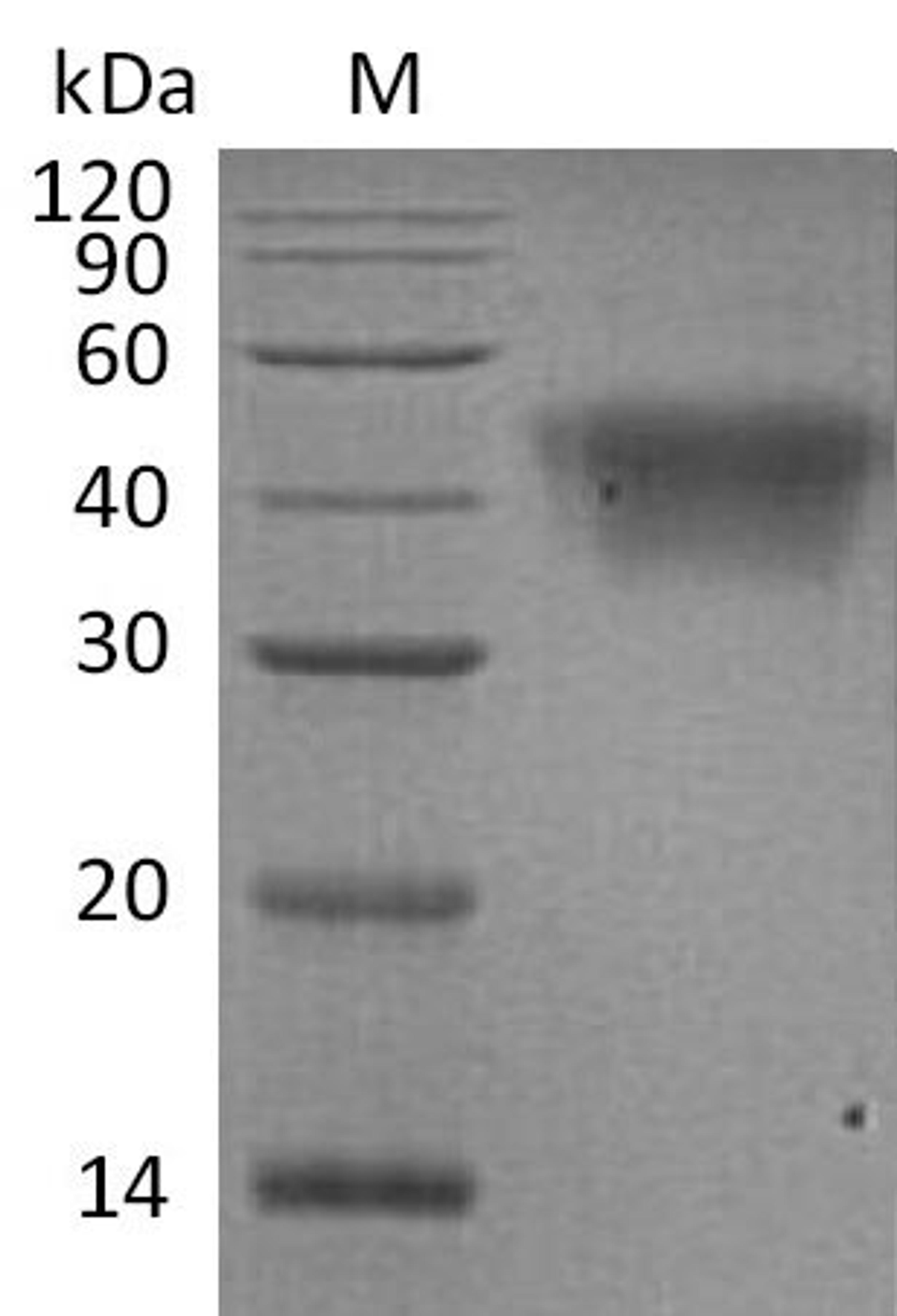 (Tris-Glycine gel) Discontinuous SDS-PAGE (reduced) with 5% enrichment gel and 15% separation gel.