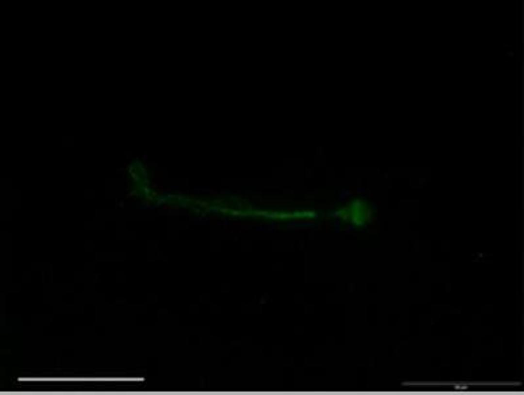 Immunocytochemistry/Immunofluorescence: SCN7A Antibody [NB100-81029] - Staining of sodium channel protein type 7 subunit alpha in human sperm cells.