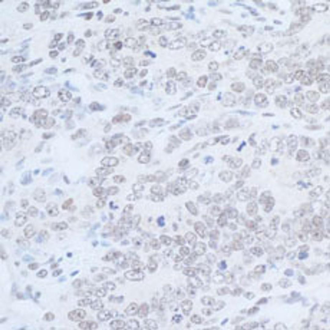 Detection of mouse Rad6 by immunohistochemistry.