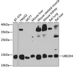 Western blot - UBE2D4 antibody (A8332)