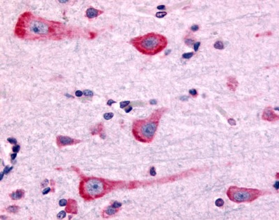 Immunohistochemistry-Paraffin: Dopamine D2 R/DRD2 Antibody [NLS1403] - Analysis of anti-DRD2 antibody with human brain, neurons and glia at 3 ug/ml.