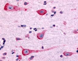 Immunohistochemistry-Paraffin: Dopamine D2 R/DRD2 Antibody [NLS1403] - Analysis of anti-DRD2 antibody with human brain, neurons and glia at 3 ug/ml.