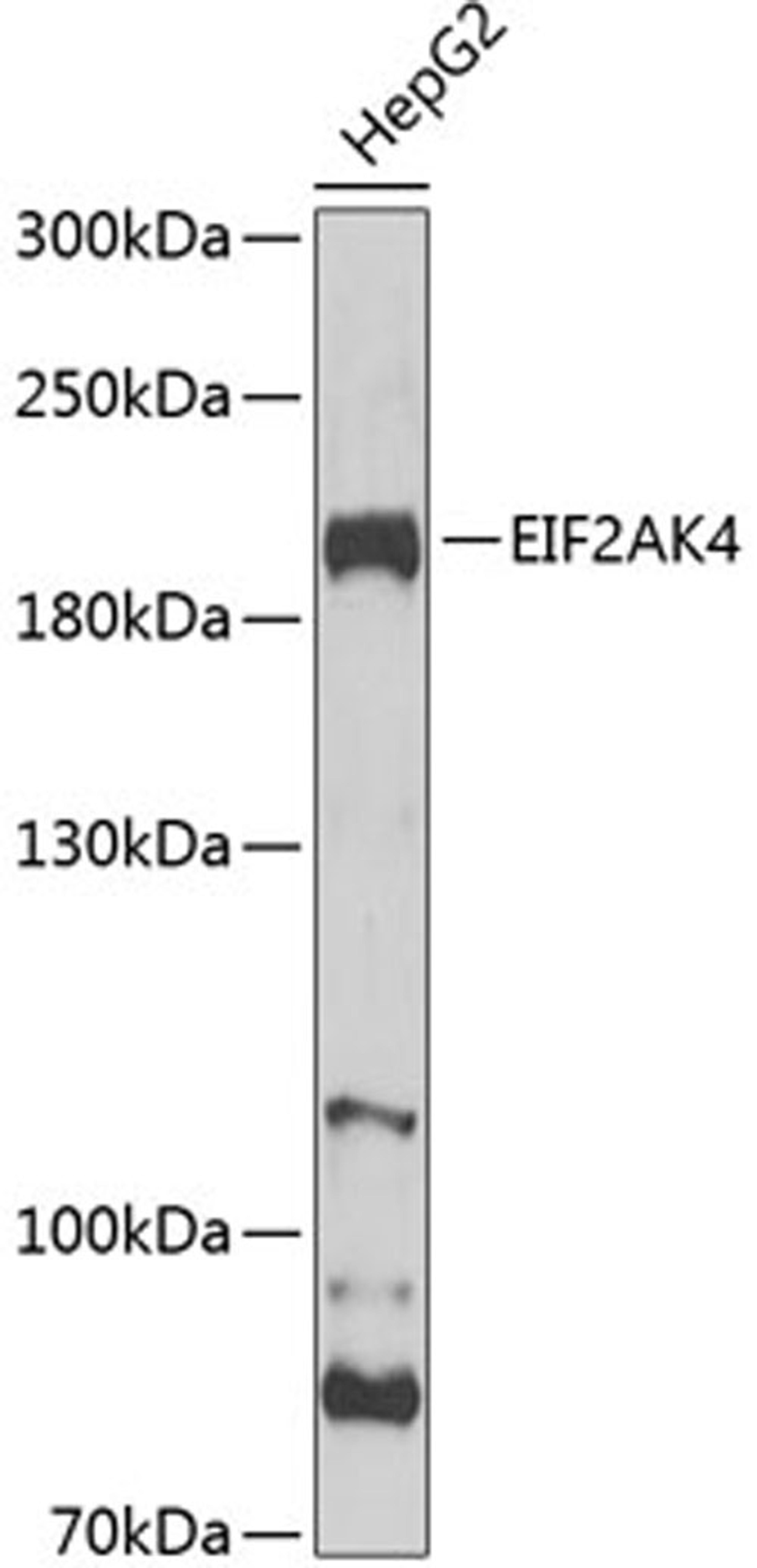 Western blot - EIF2AK4 Antibody (A12618)