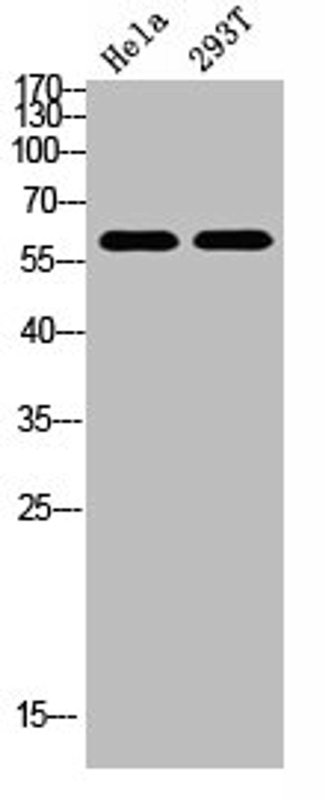 Western Blot analysis of HELA, 293t cells using Antibody diluted at 800. Secondary antibody  was diluted at 1:20000