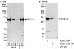 Detection of human EPS15 by western blot and immunoprecipitation.