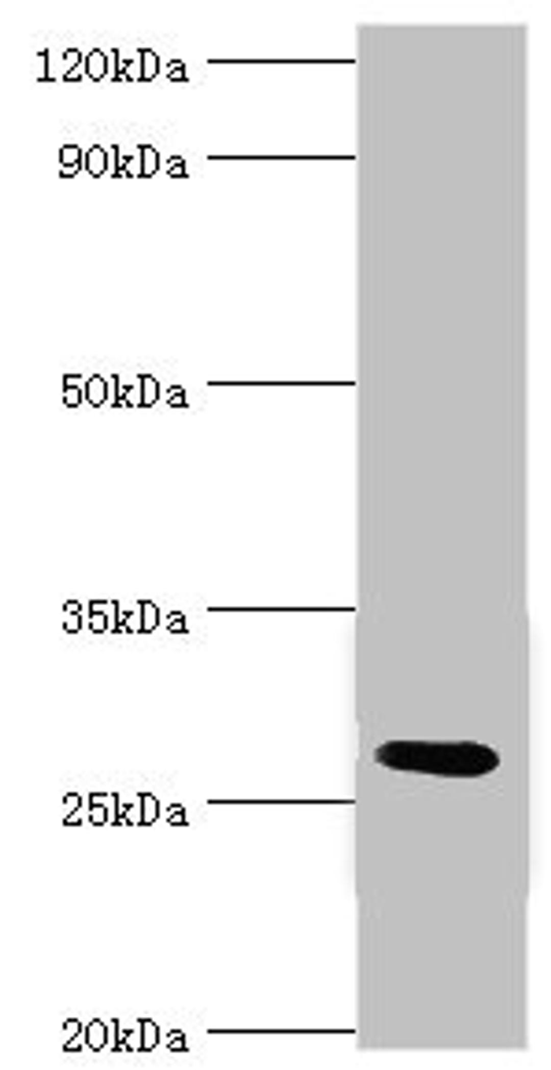 Western blot. All lanes: C4b-binding protein beta chain antibody at 6ug/ml + Mouse liver tissue. Secondary. Goat polyclonal to rabbit IgG at 1/10000 dilution. Predicted band size: 28 kDa. Observed band size: 28 kDa. 
