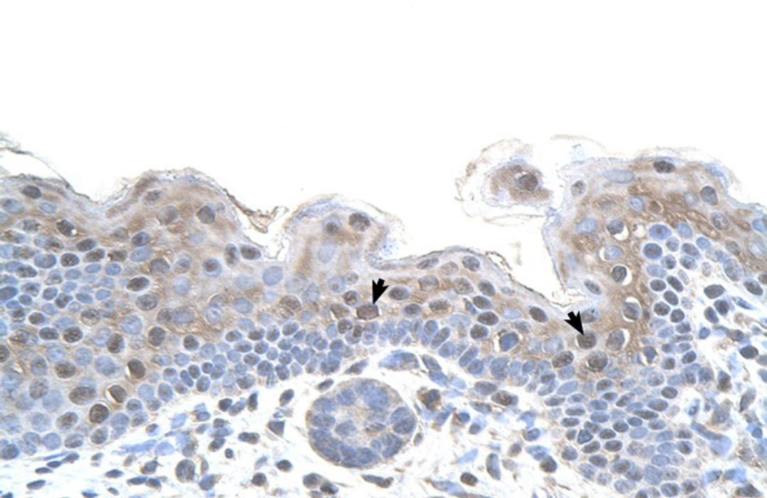 Antibody used in IHC on Human Skin.