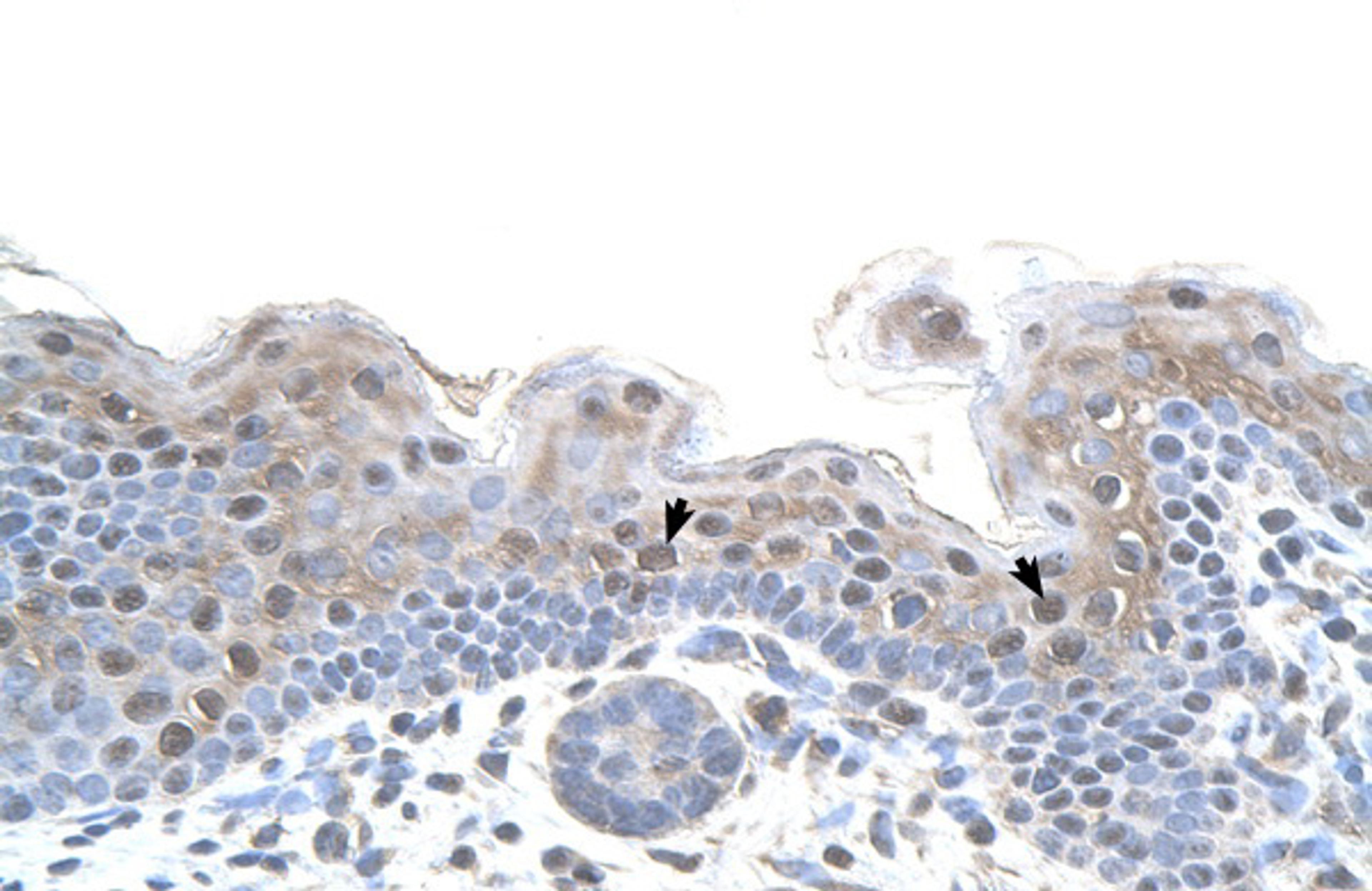 Antibody used in IHC on Human Skin.