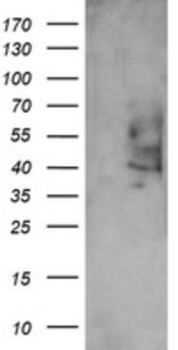 Western Blot: Prostaglandin E Synthase 2/PTGES2 Antibody (2C3) [NBP2-45904] - Analysis of HEK293T cells were transfected with the pCMV6-ENTRY control (Left lane) or pCMV6-ENTRY PTGES2.