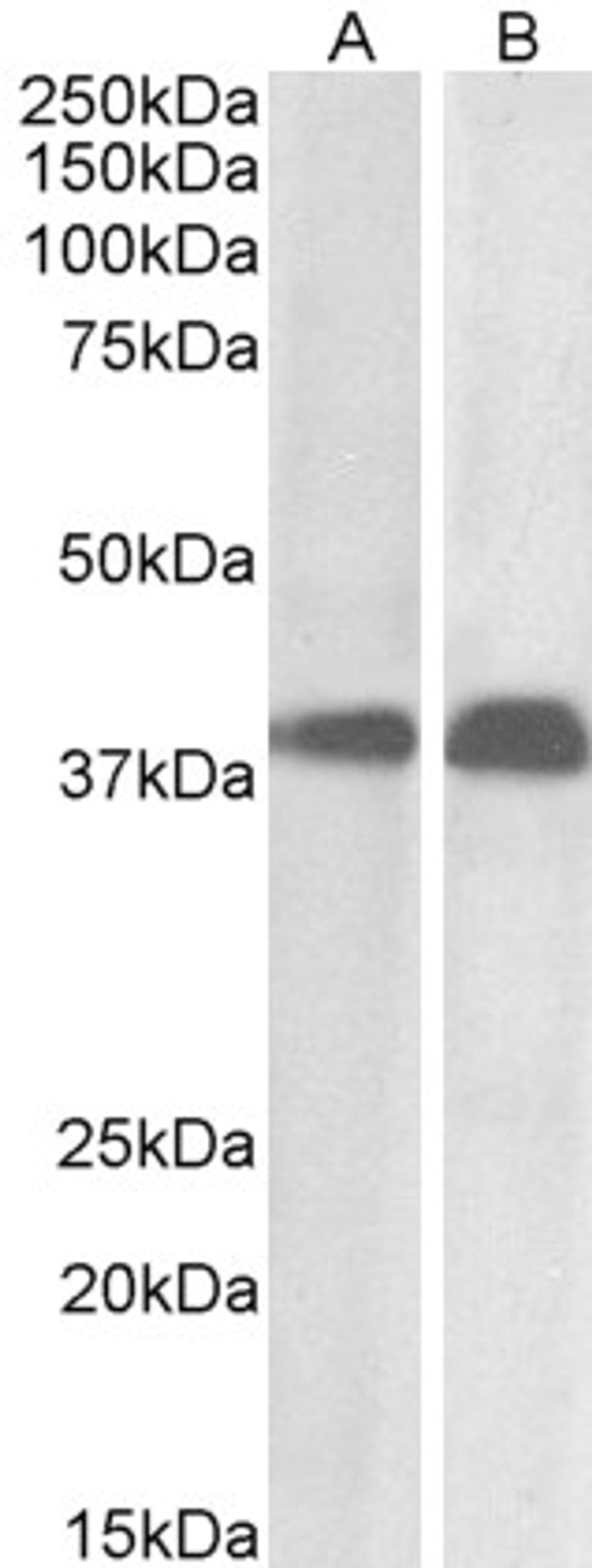 46-360 (0.01ug/ml) staining of Daudi (A) and Molt4 (B) cell lysate (35ug protein in RIPA buffer). Primary incubation was 1 hour. Detected by chemiluminescence.