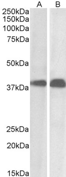 46-360 (0.01ug/ml) staining of Daudi (A) and Molt4 (B) cell lysate (35ug protein in RIPA buffer). Primary incubation was 1 hour. Detected by chemiluminescence.