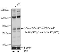 Western blot - Phospho-Smad1(Ser463/465)/Smad5(Ser463/465)/Smad9(Ser465/467) pAb (AP0850)