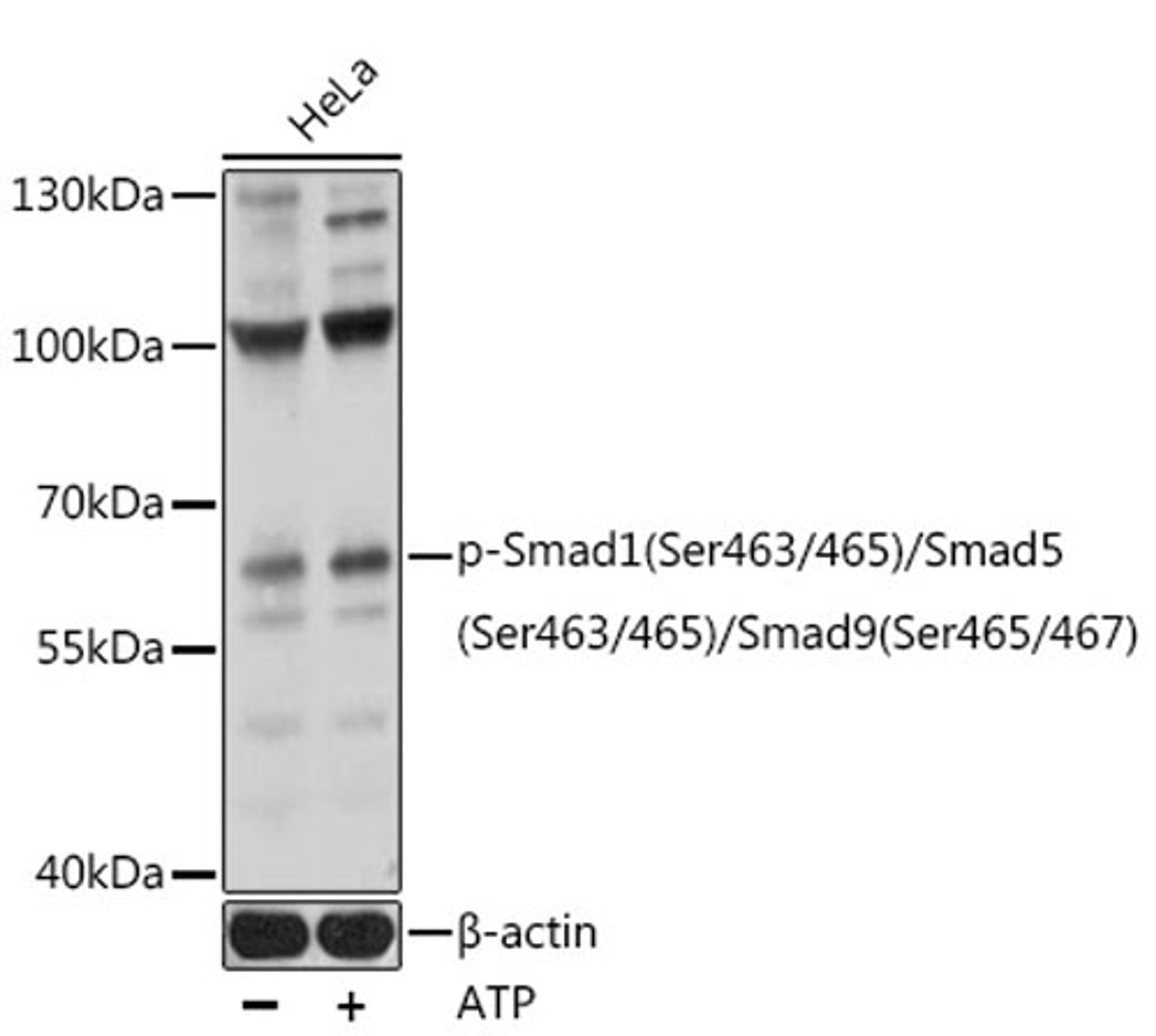 Western blot - Phospho-Smad1(Ser463/465)/Smad5(Ser463/465)/Smad9(Ser465/467) pAb (AP0850)