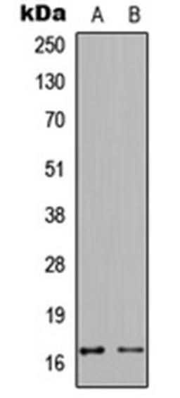 Western blot analysis of MCF7 TNF-treated (Lane 1), NIH3T3 TNF-treated (Lane 2) whole cell lysates using Calmodulin (phospho-T80/S82) antibody