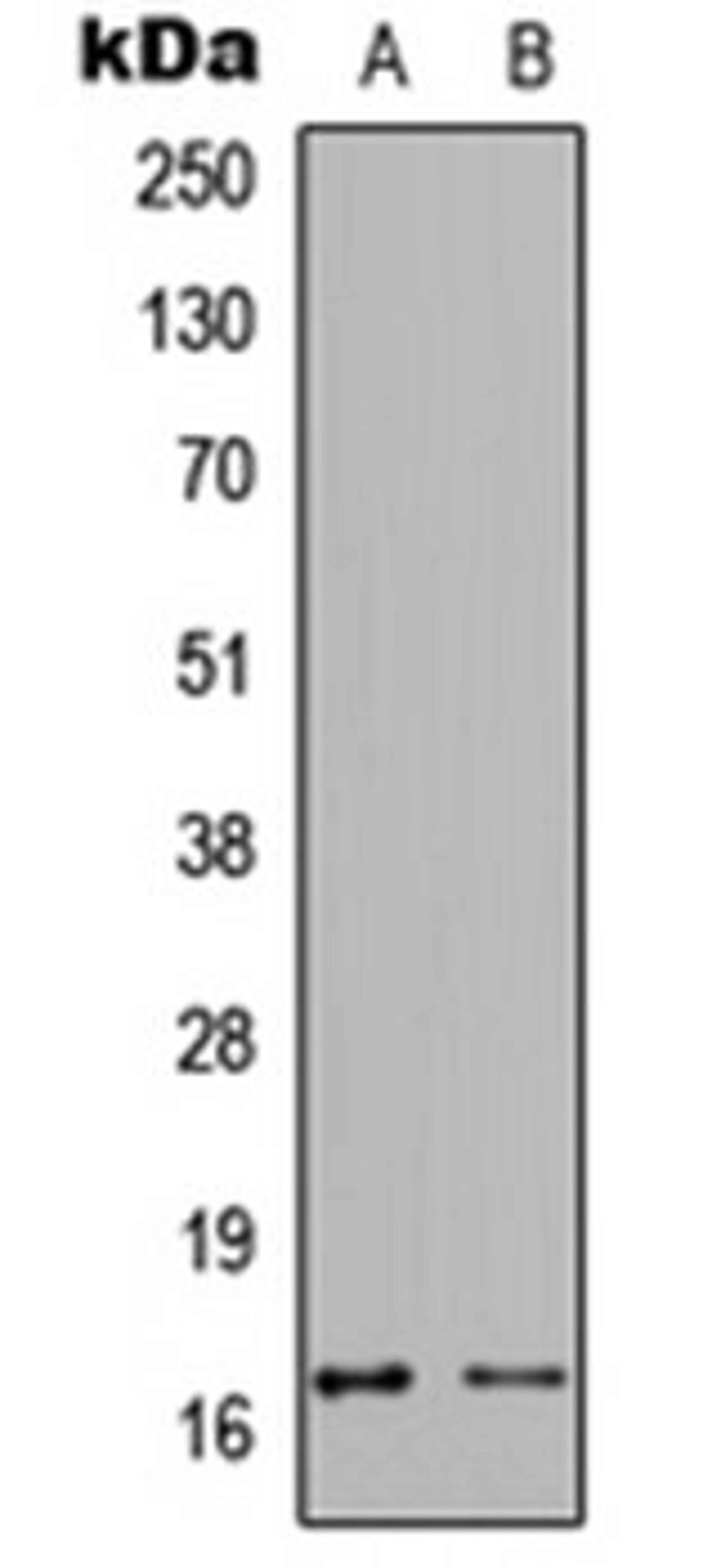 Western blot analysis of MCF7 TNF-treated (Lane 1), NIH3T3 TNF-treated (Lane 2) whole cell lysates using Calmodulin (phospho-T80/S82) antibody