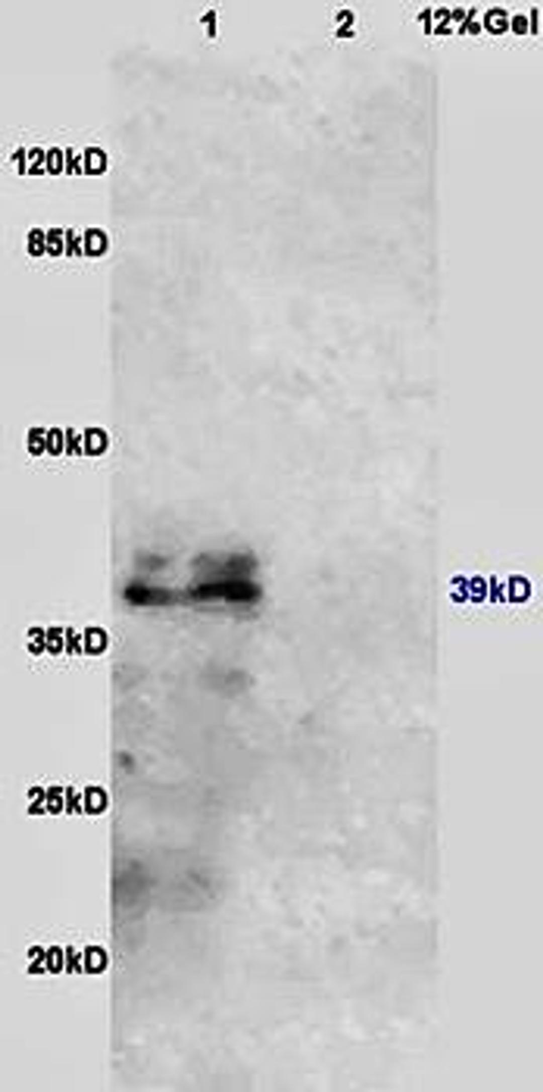 Western blot analysis of mouse kidney lysates (Lane1), mouse lung lysates (Lane2) dilution at:1:200 using beta IL10 Receptor antibody