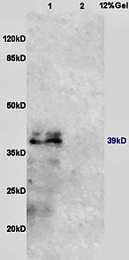 Western blot analysis of mouse kidney lysates (Lane1), mouse lung lysates (Lane2) dilution at:1:200 using beta IL10 Receptor antibody