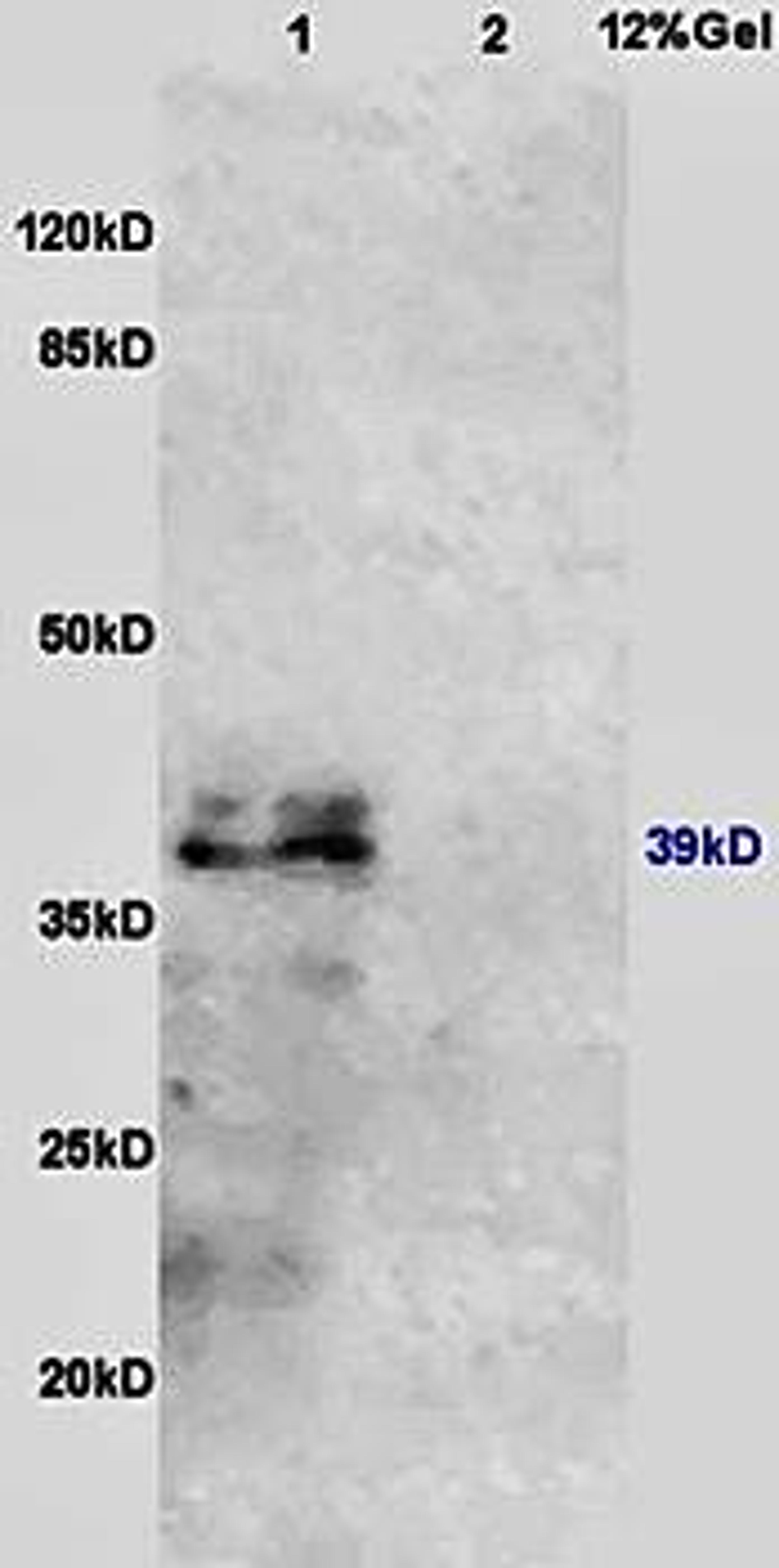 Western blot analysis of mouse kidney lysates (Lane1), mouse lung lysates (Lane2) dilution at:1:200 using beta IL10 Receptor antibody