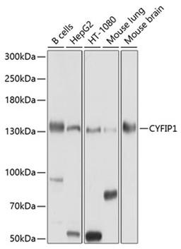 Western blot - CYFIP1 antibody (A10291)