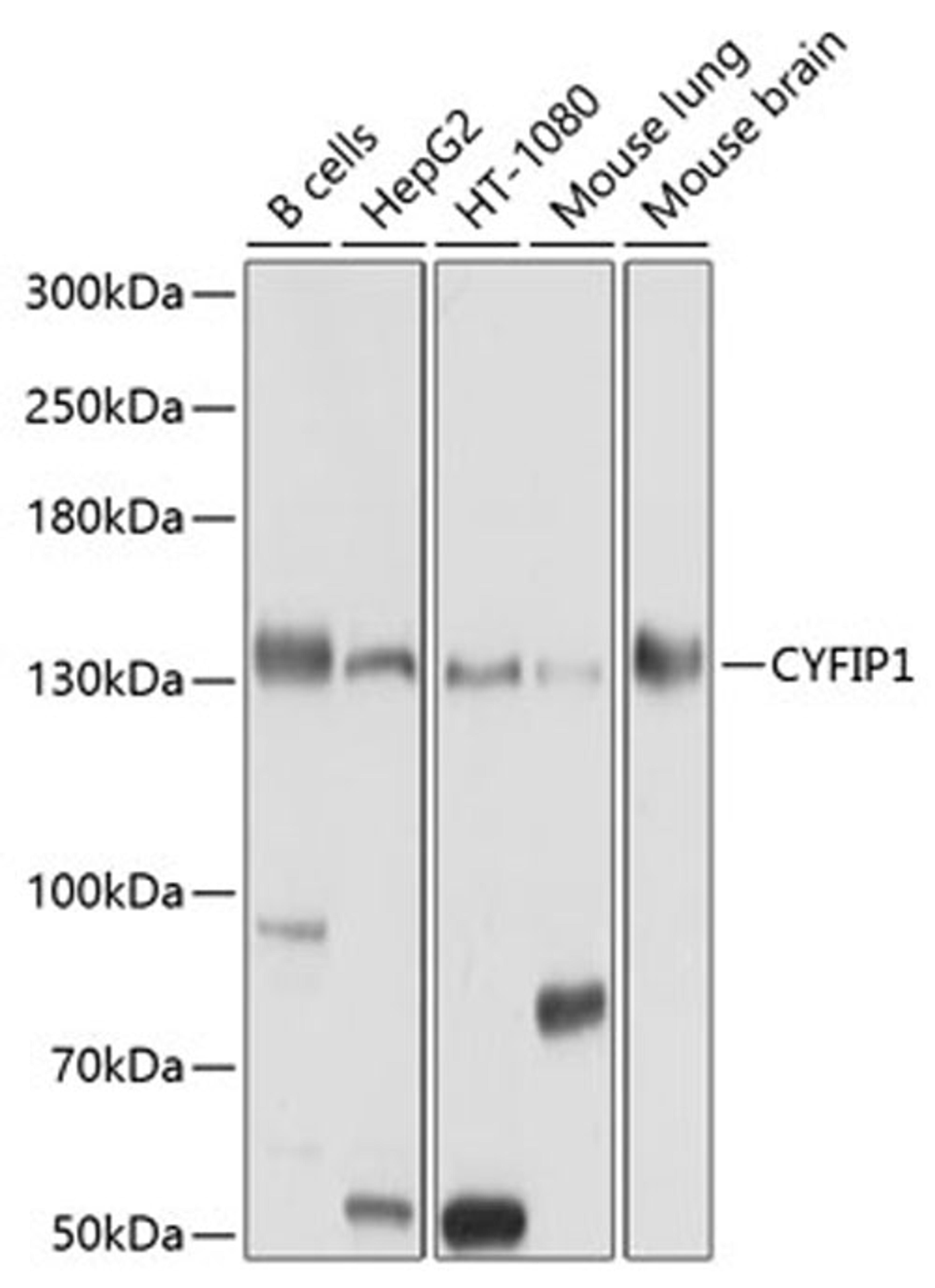 Western blot - CYFIP1 antibody (A10291)