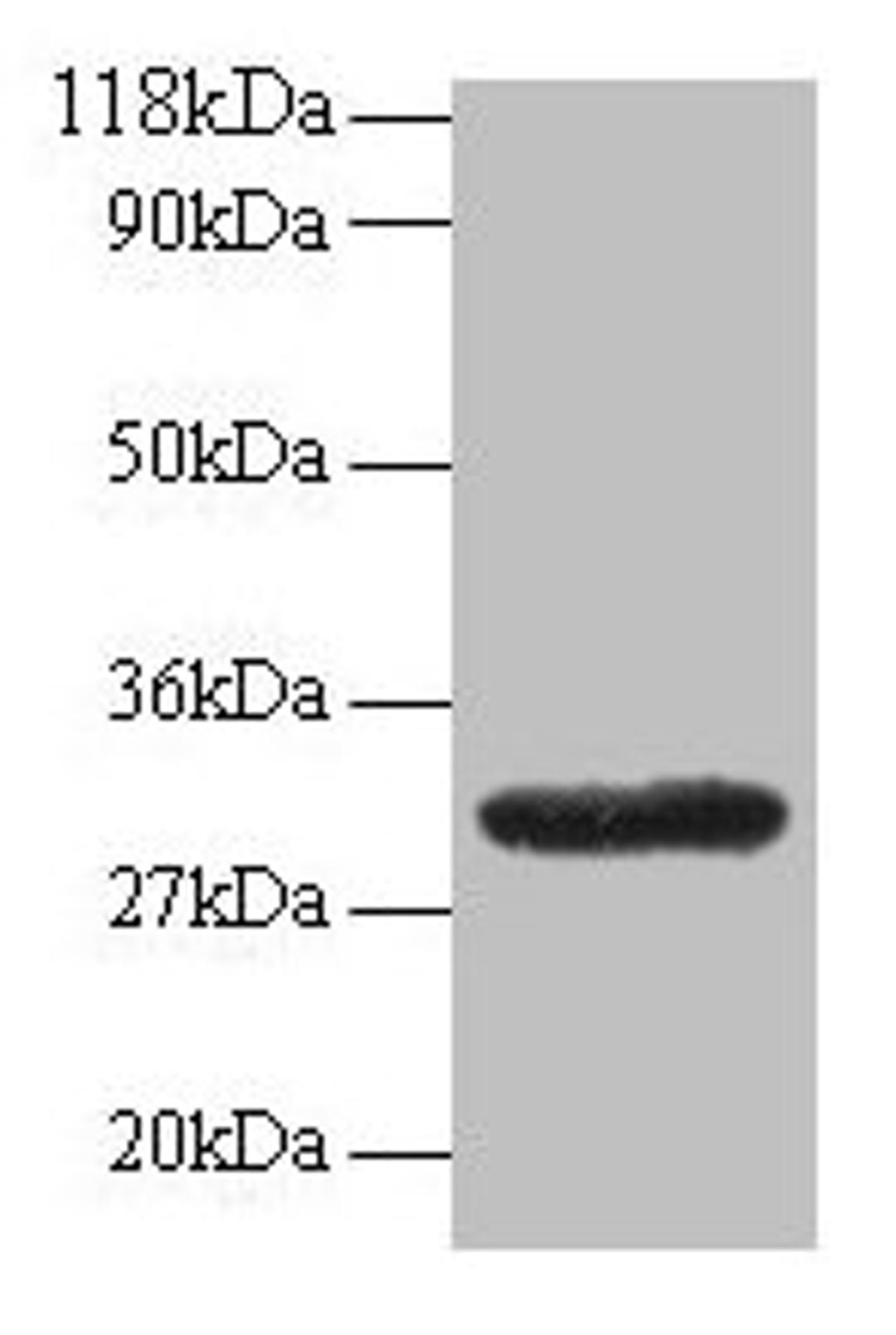Western blot. All lanes: GPR161 antibody at 2µg/ml + EC109 whole cell lysate. Secondary. Goat polyclonal to rabbit IgG at 1/15000 dilution. Predicted band size: 59, 46, 44, 50, 47, 61 kDa. Observed band size: 30 kDa