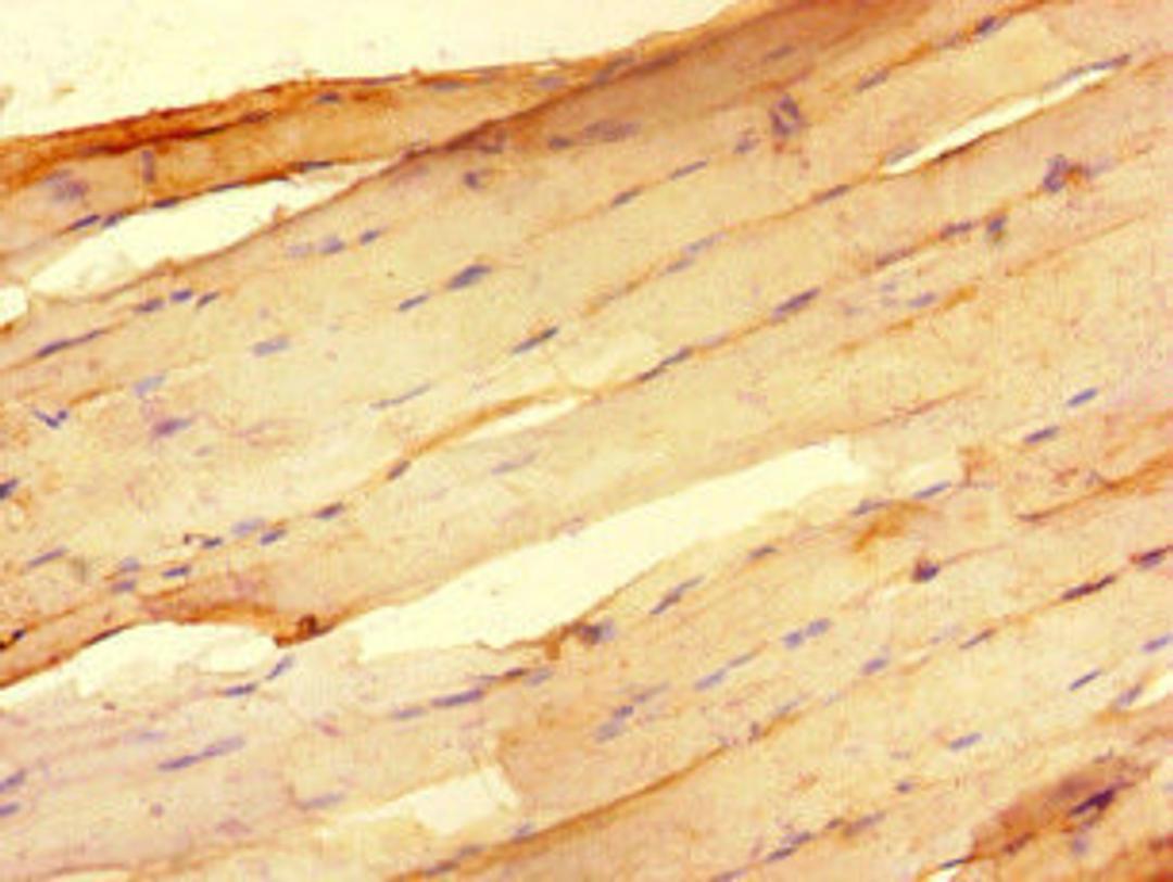 Immunohistochemistry of paraffin-embedded human skeletal muscle tissue using CSB-PA019889LA01HU at dilution of 1:100