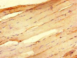 Immunohistochemistry of paraffin-embedded human skeletal muscle tissue using CSB-PA019889LA01HU at dilution of 1:100