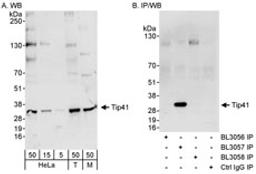 Detection of human and mouse Tip41 by western blot (h & m) and immunoprecipitation (h).