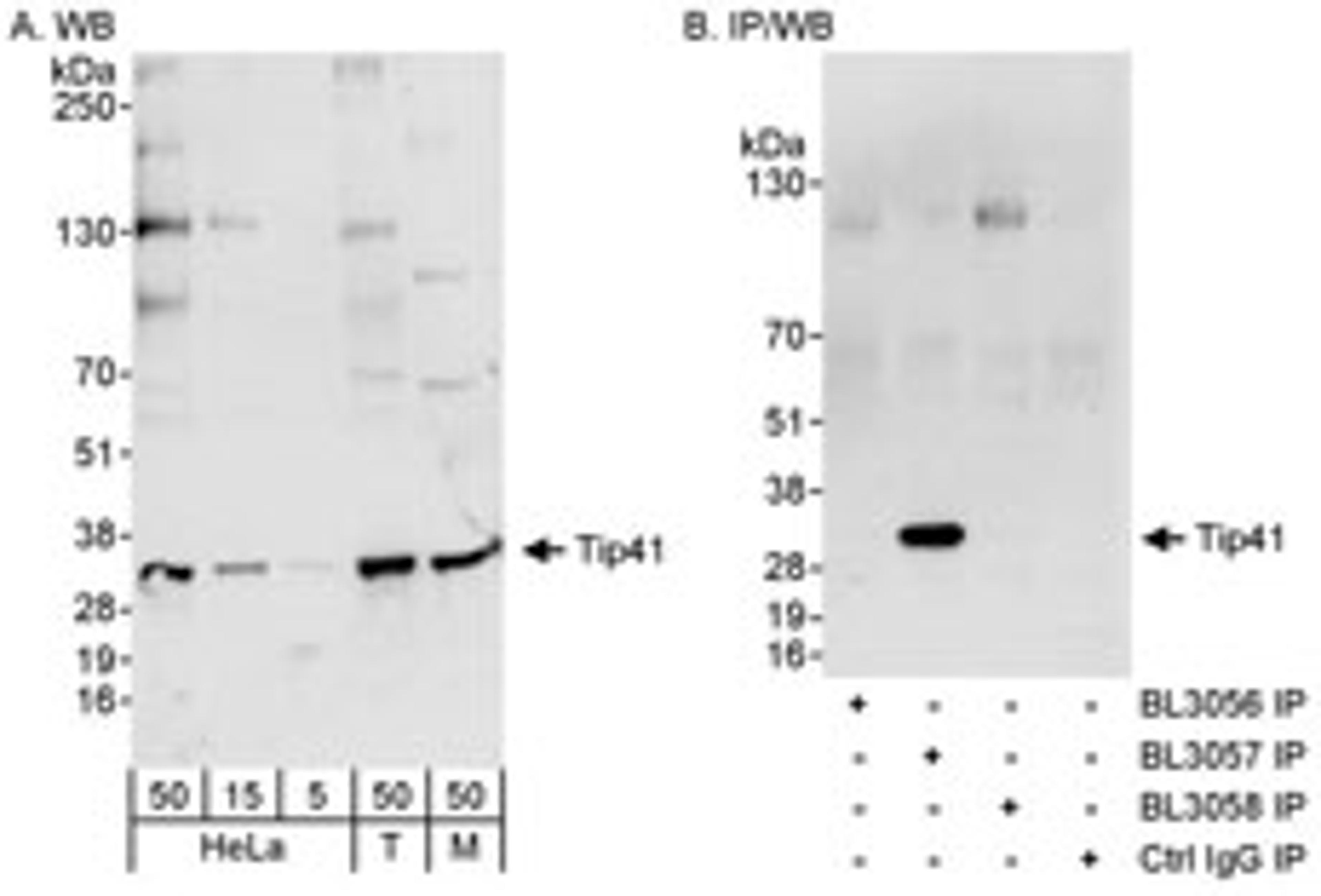 Detection of human and mouse Tip41 by western blot (h & m) and immunoprecipitation (h).