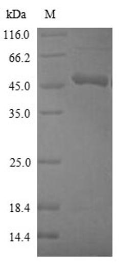 (Tris-Glycine gel) Discontinuous SDS-PAGE (reduced) with 5% enrichment gel and 15% separation gel.