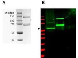 Western blot analysis of HeLa WC lysate (lane 1) and purified recombinant GST-SAE1 (lane 2) using Sumo Activating Enzyme E1 antibody