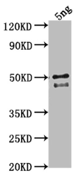 Western Blot. Positive WB detected in Recombinant protein. All lanes: DGAT3 antibody at 1:2000. Secondary. Goat polyclonal to rabbit IgG at 1/50000 dilution. Predicted band size: 43.2 kDa. Observed band size: 44 kDa. 