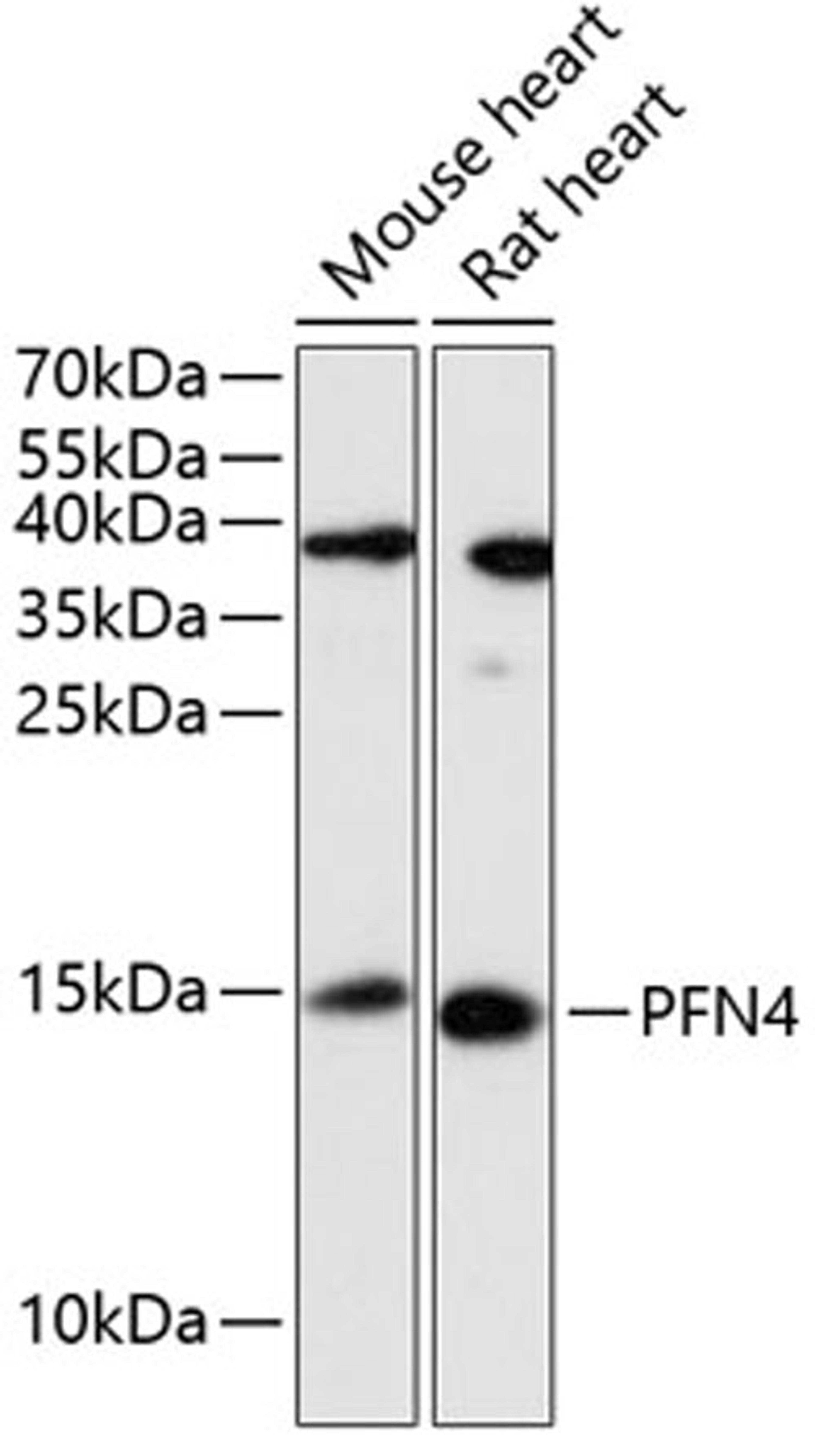 Western blot - PFN4 antibody (A13692)