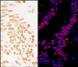 Detection of human ZNF326 by immunohistochemistry.