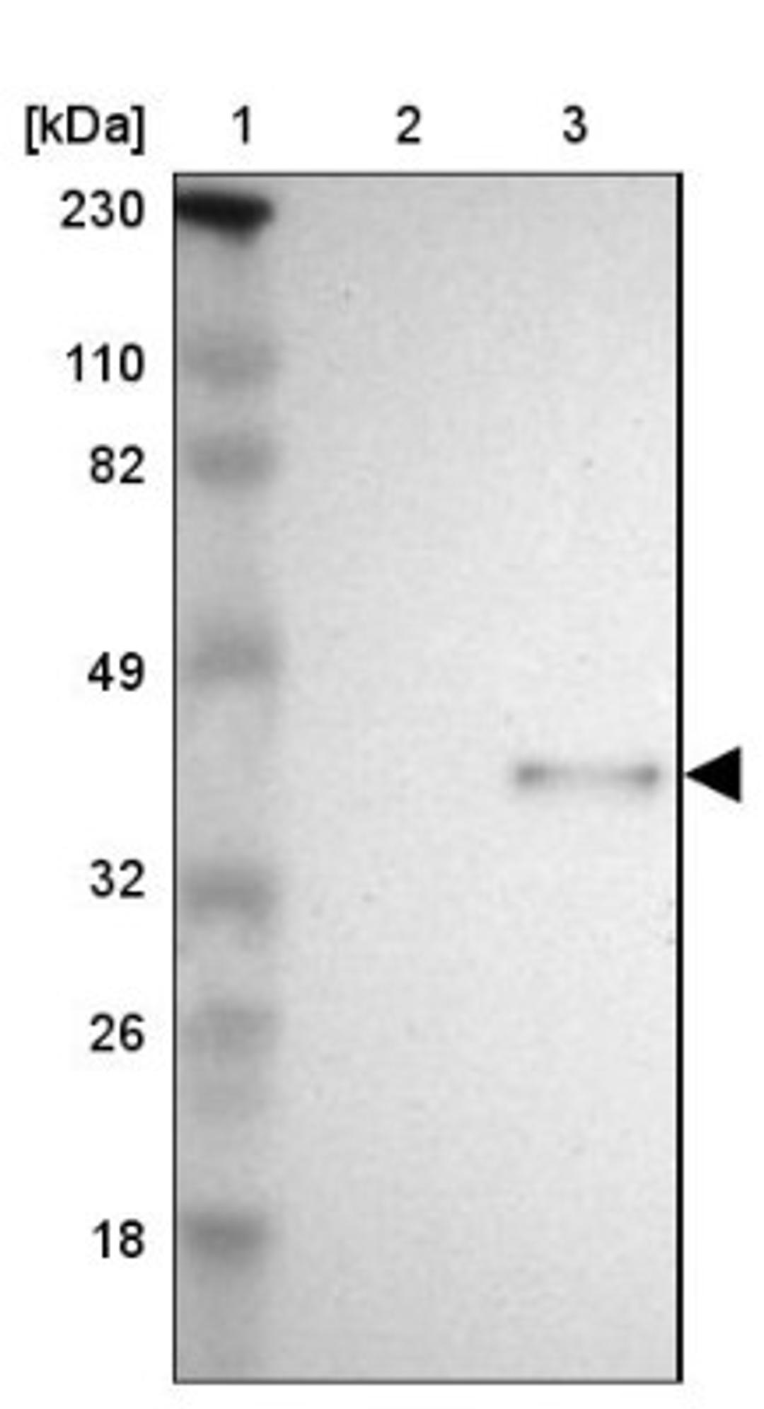 Western Blot: SPARC Antibody [NBP1-80972] - Lane 1: Marker [kDa] 230, 110, 82, 49, 32, 26, 18<br/>Lane 2: Human cell line RT-4<br/>Lane 3: Human cell line U-251MG sp