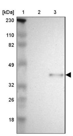 Western Blot: SPARC Antibody [NBP1-80972] - Lane 1: Marker [kDa] 230, 110, 82, 49, 32, 26, 18<br/>Lane 2: Human cell line RT-4<br/>Lane 3: Human cell line U-251MG sp