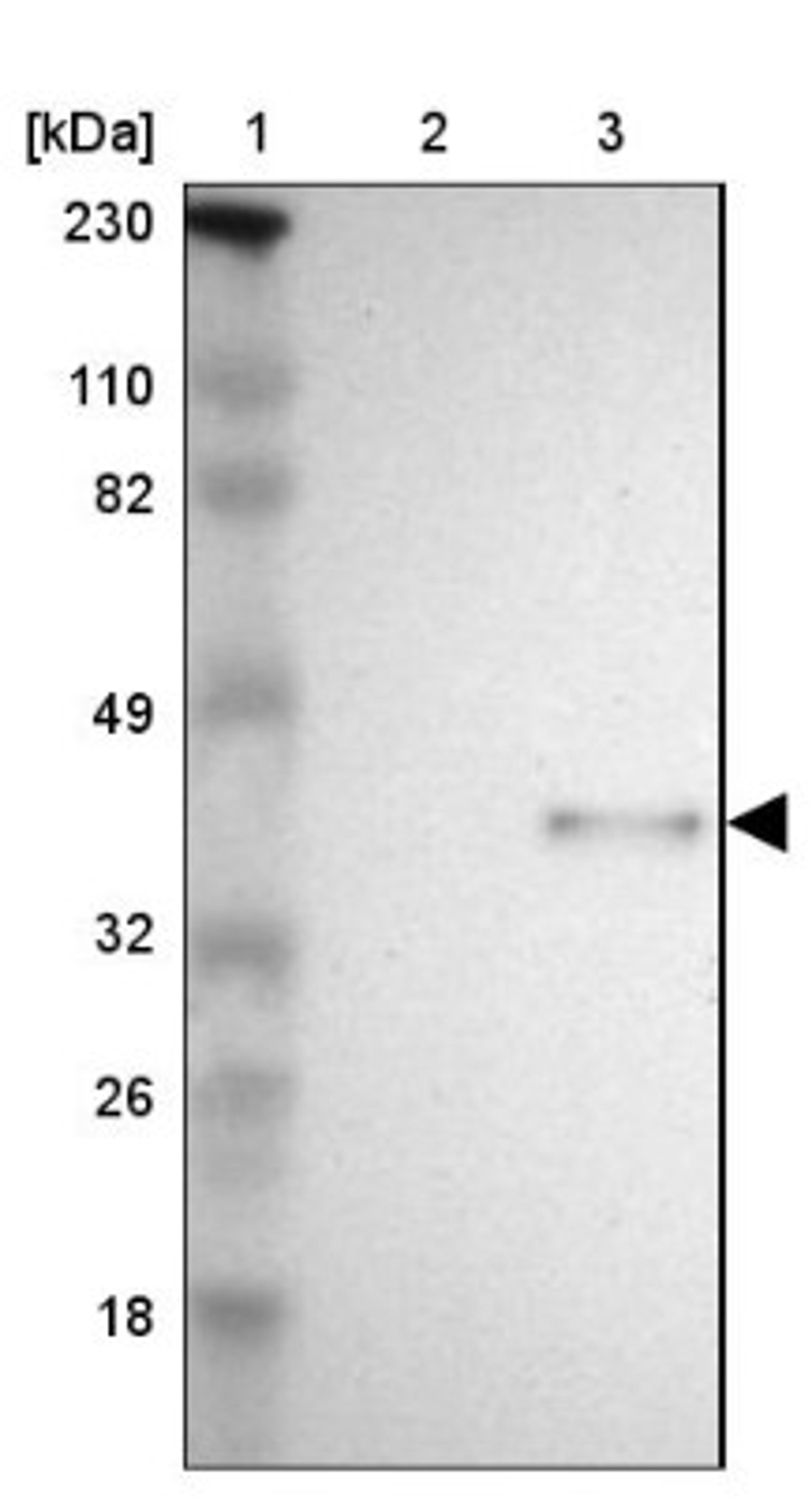 Western Blot: SPARC Antibody [NBP1-80972] - Lane 1: Marker [kDa] 230, 110, 82, 49, 32, 26, 18<br/>Lane 2: Human cell line RT-4<br/>Lane 3: Human cell line U-251MG sp