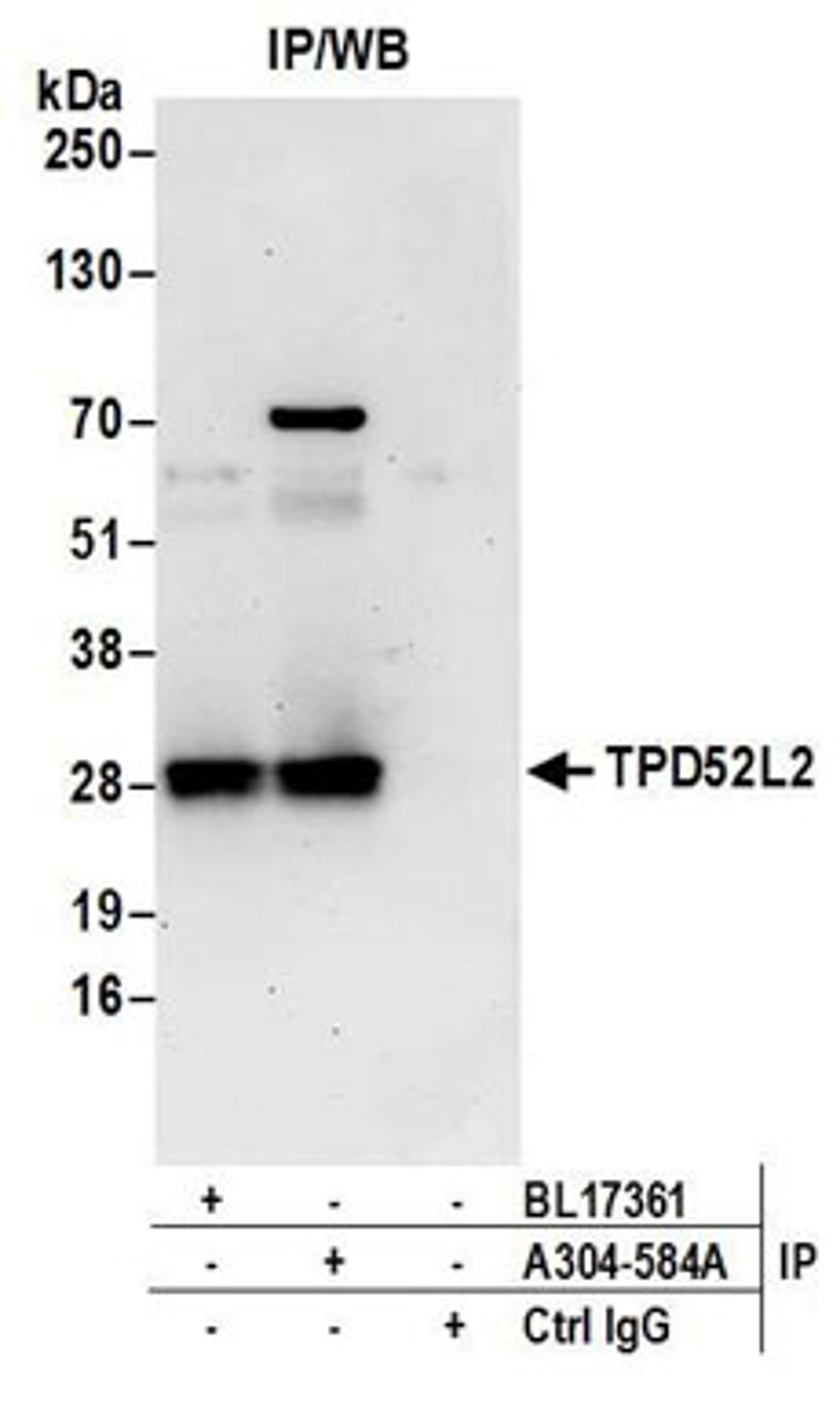 Detection of human TPD52L2 by western blot of immunoprecipitates.