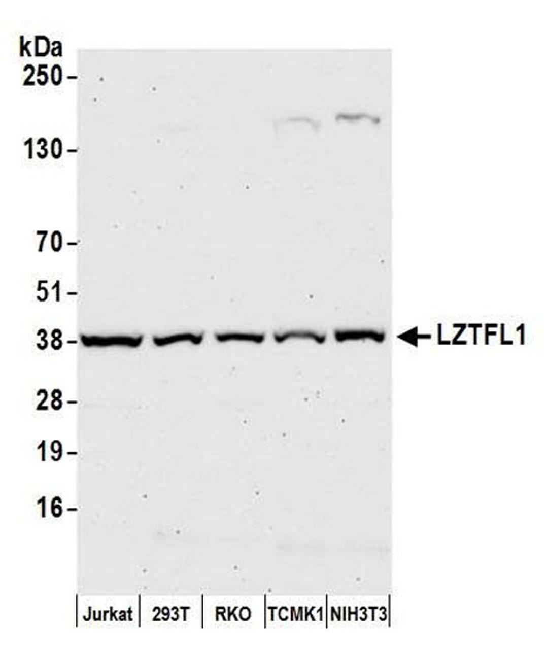 Detection of human and mouse LZTFL1 by WB.