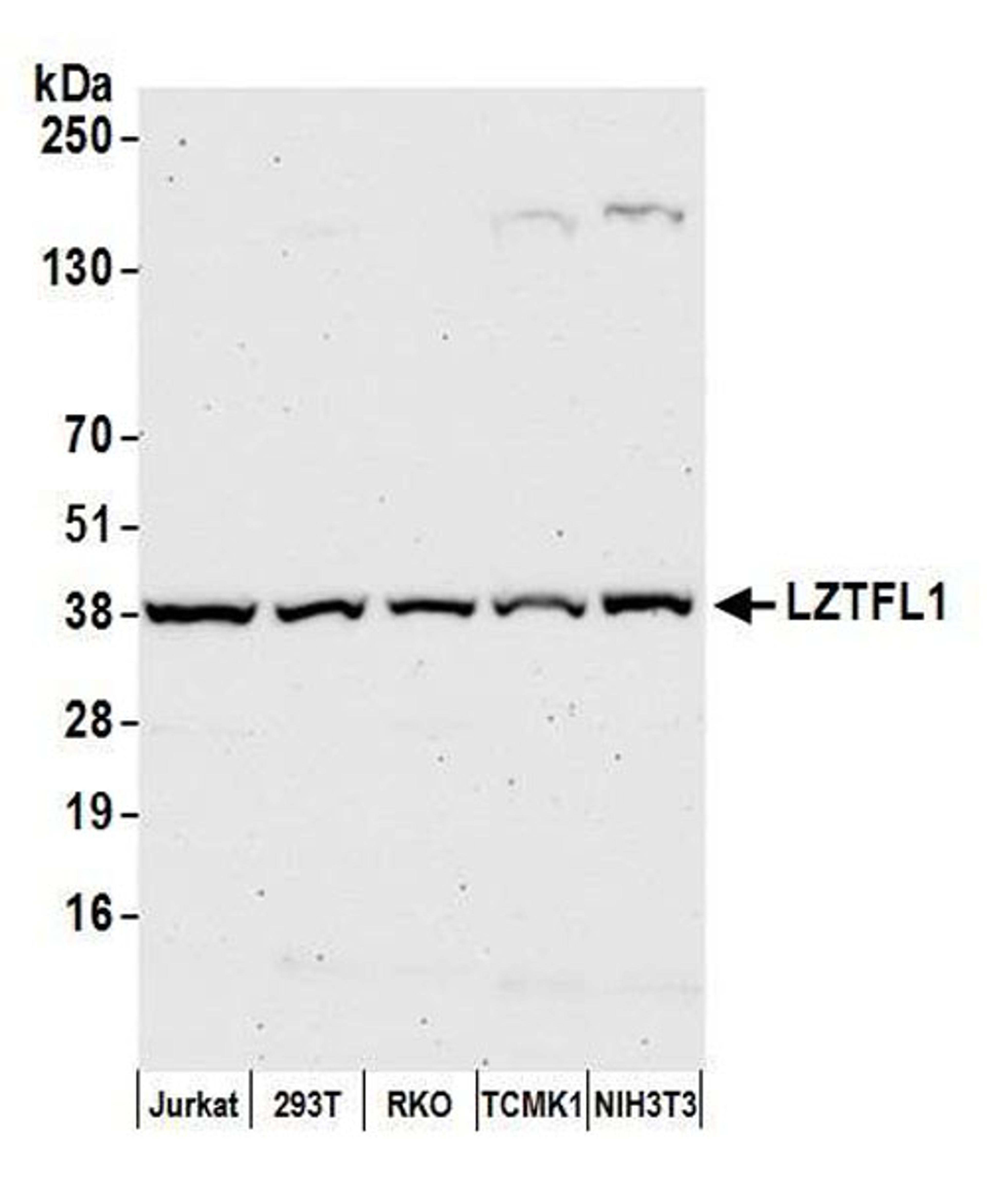 Detection of human and mouse LZTFL1 by WB.