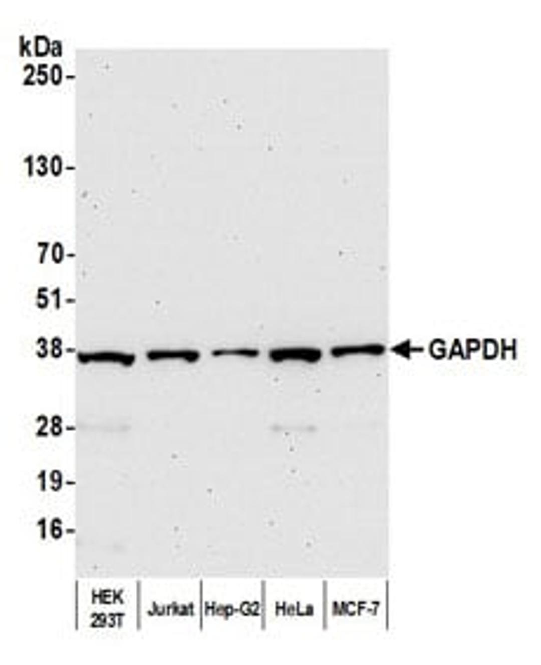 Detection of human GAPDH by western blot.