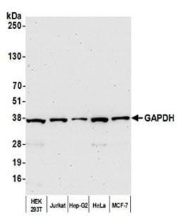 Detection of human GAPDH by western blot.