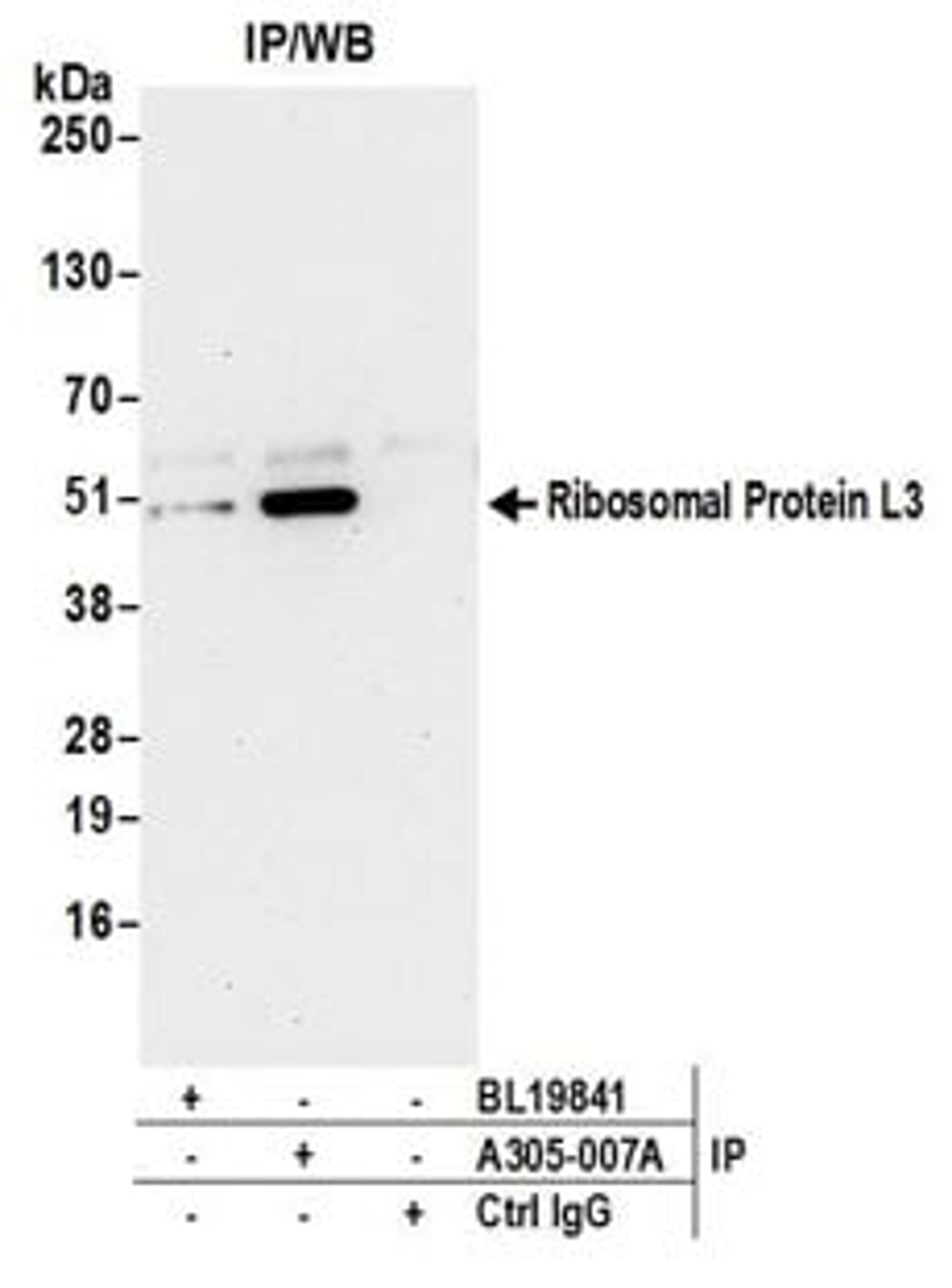 Detection of human Ribosomal Protein L3 by western blot of immunoprecipitates.