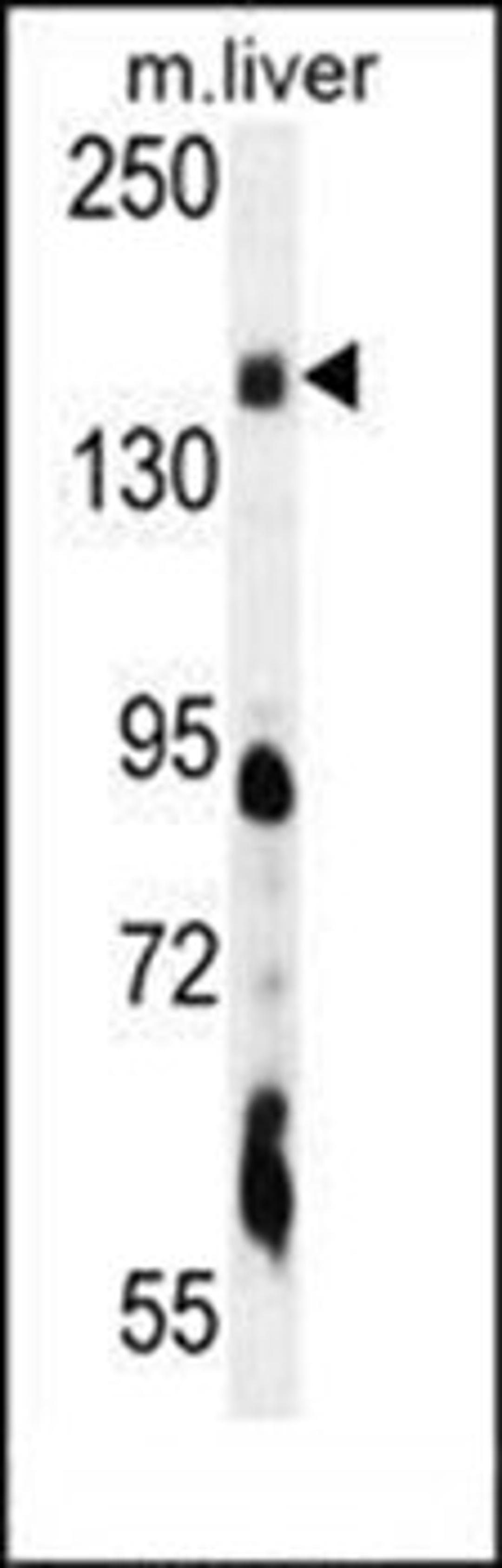 Western blot analysis of mouse liver tissue lysates (35ug/lane) using PIK3C2A antibody (C-term)