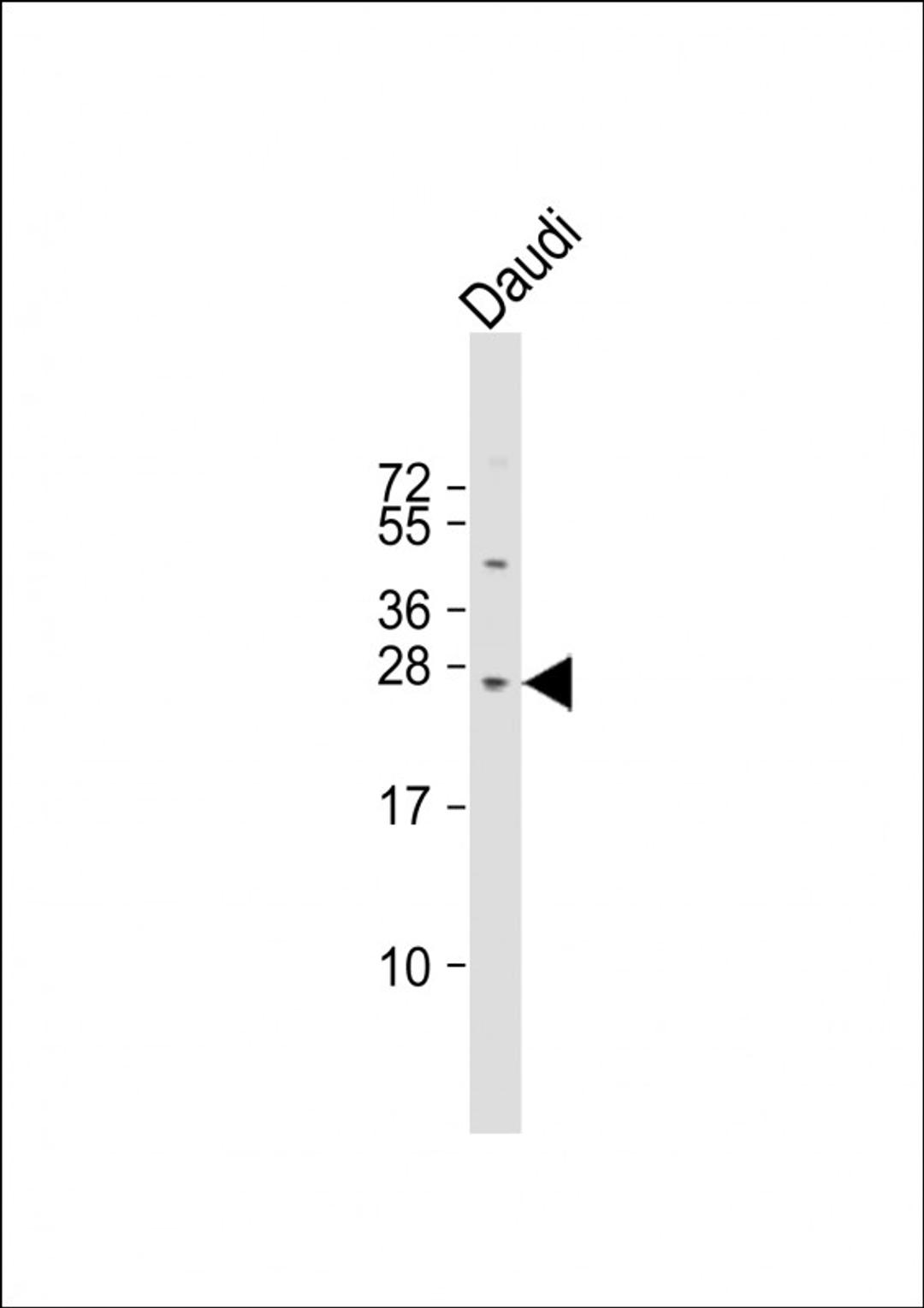 Western Blot at 1:1000 dilution + Daudi whole cell lysate Lysates/proteins at 20 ug per lane.